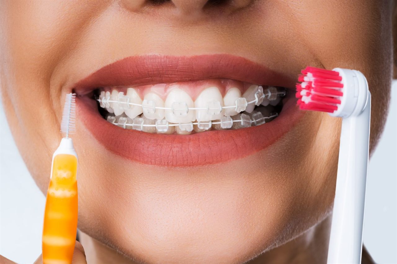 Sonrisa con brackets estéticos, cepillo dental y cepillo interdental
